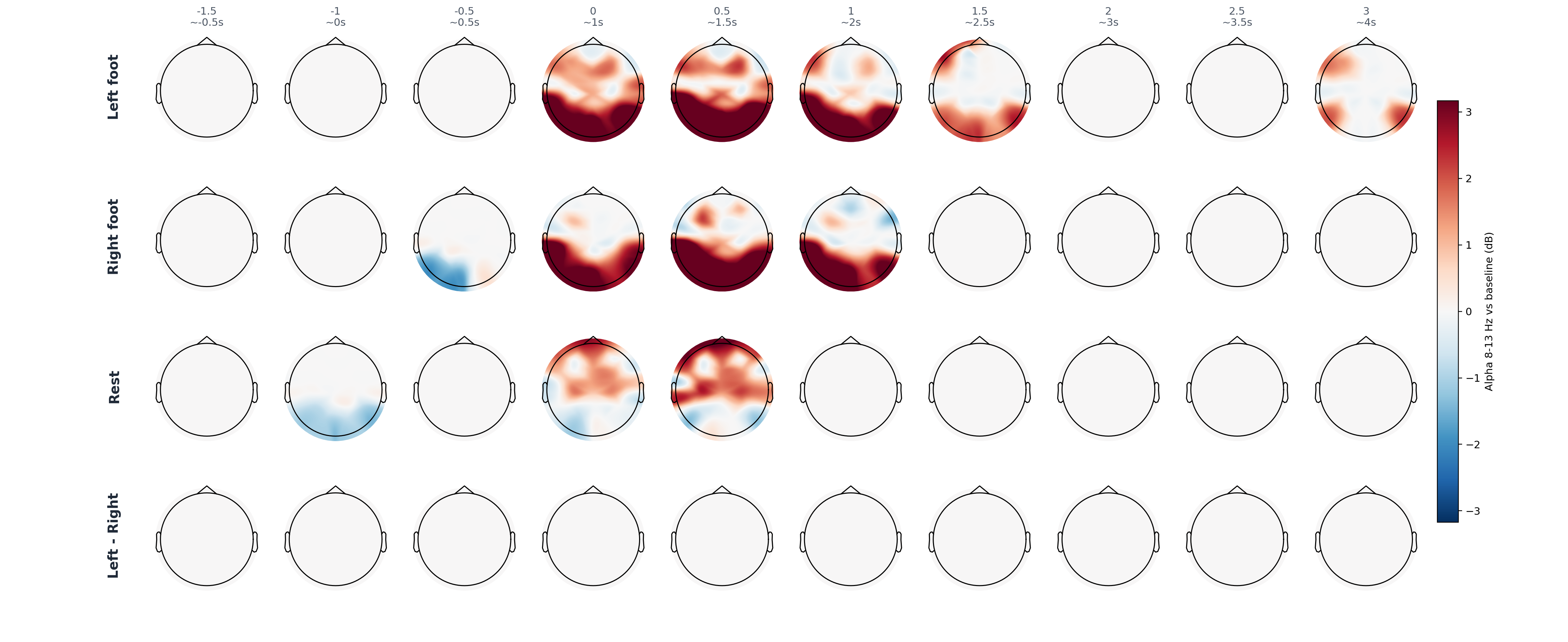 sub11 alpha topomap