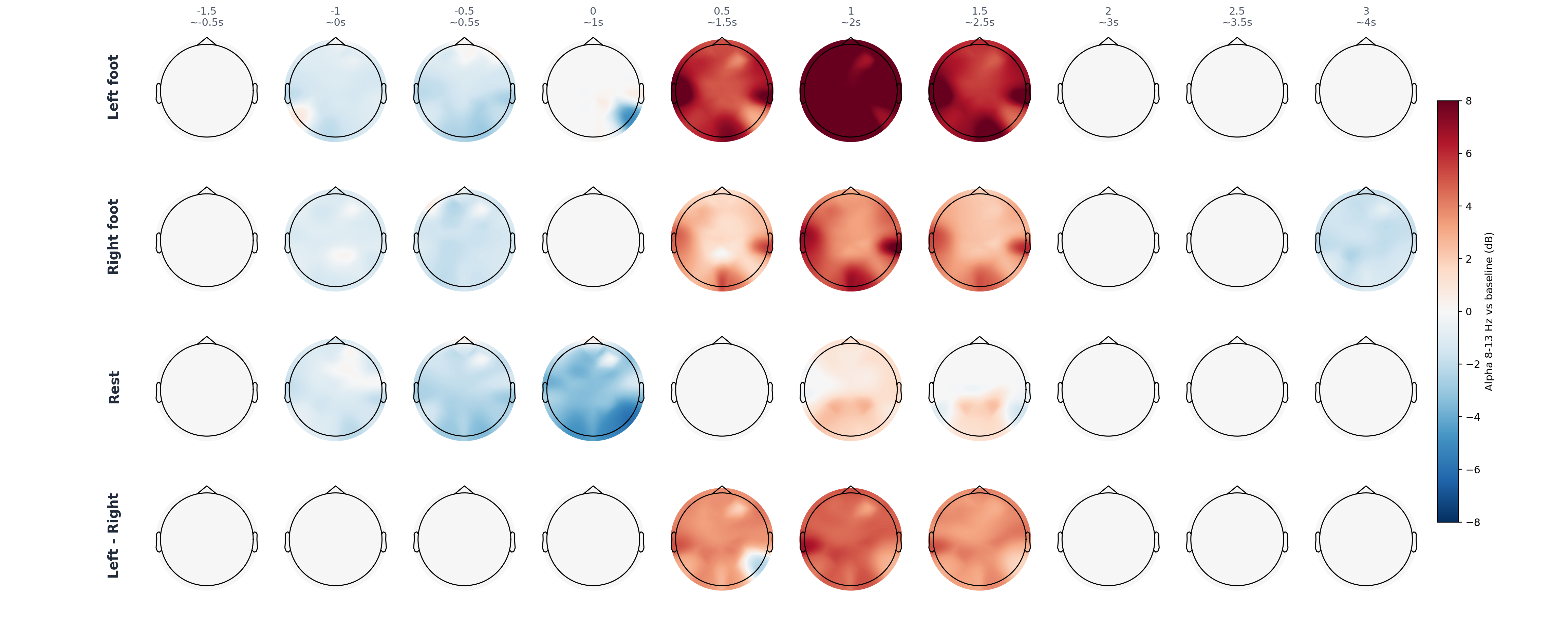 sub13 alpha topomap