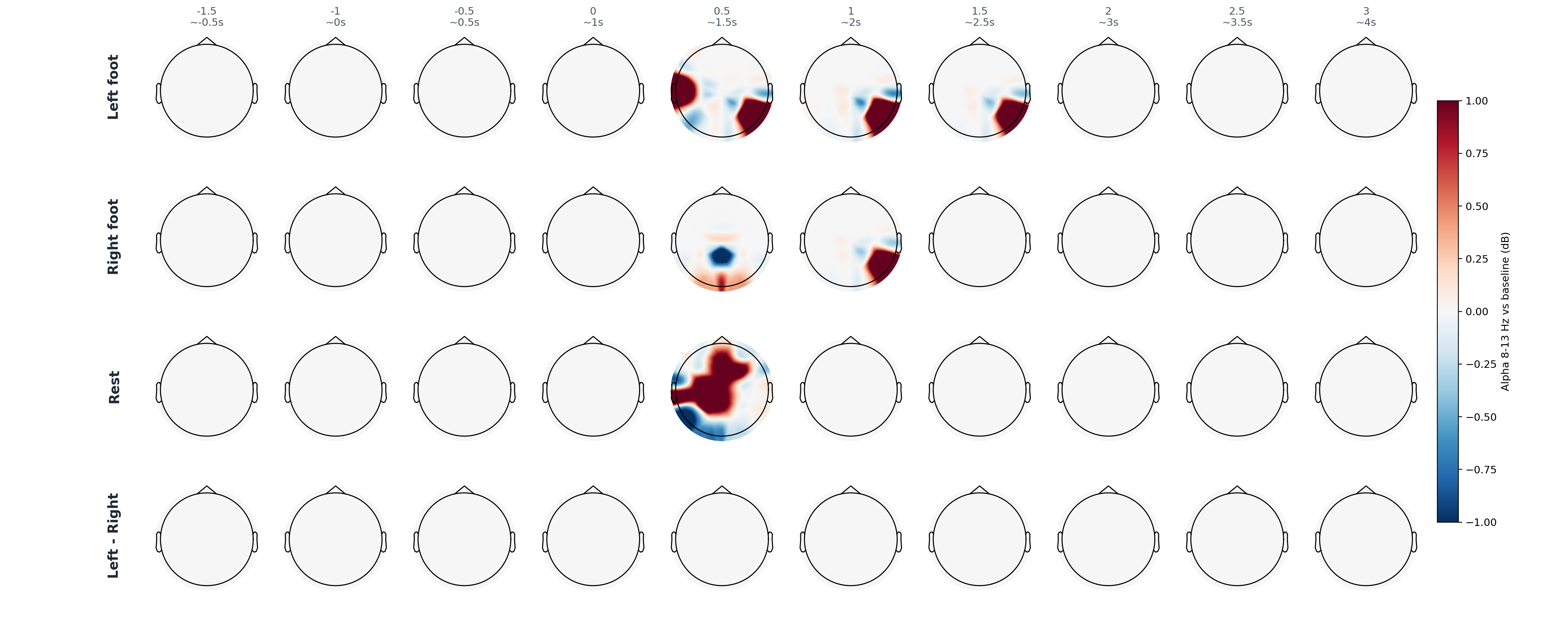 sub15 alpha topomap