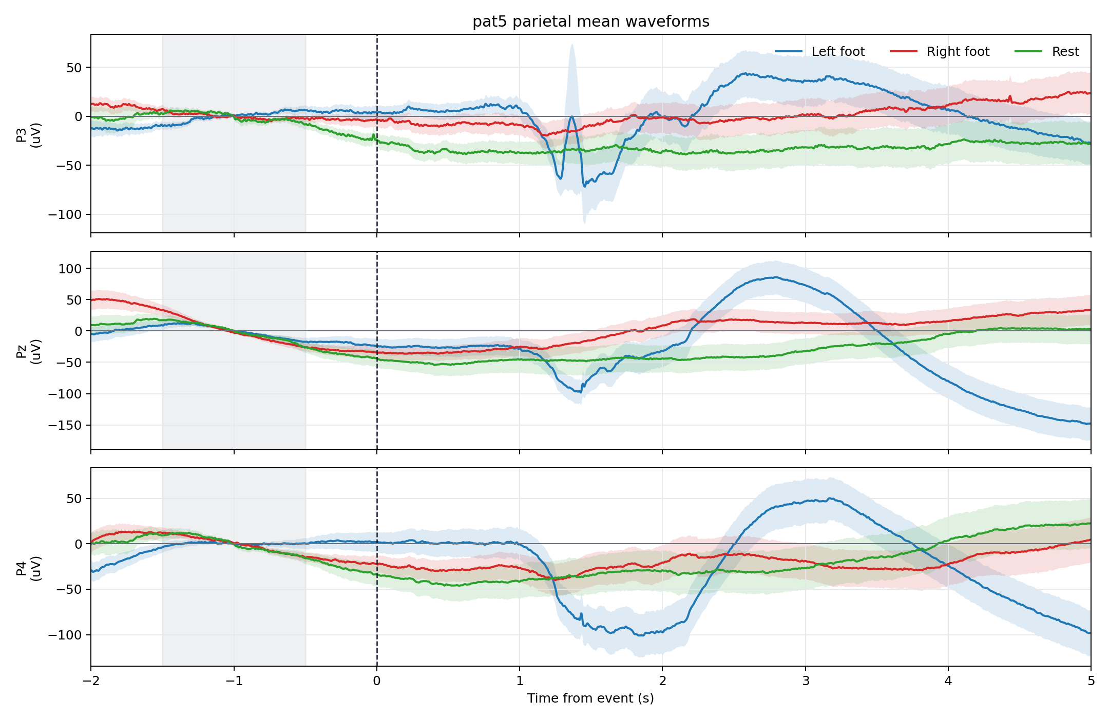 pat5 parietal mean waveforms