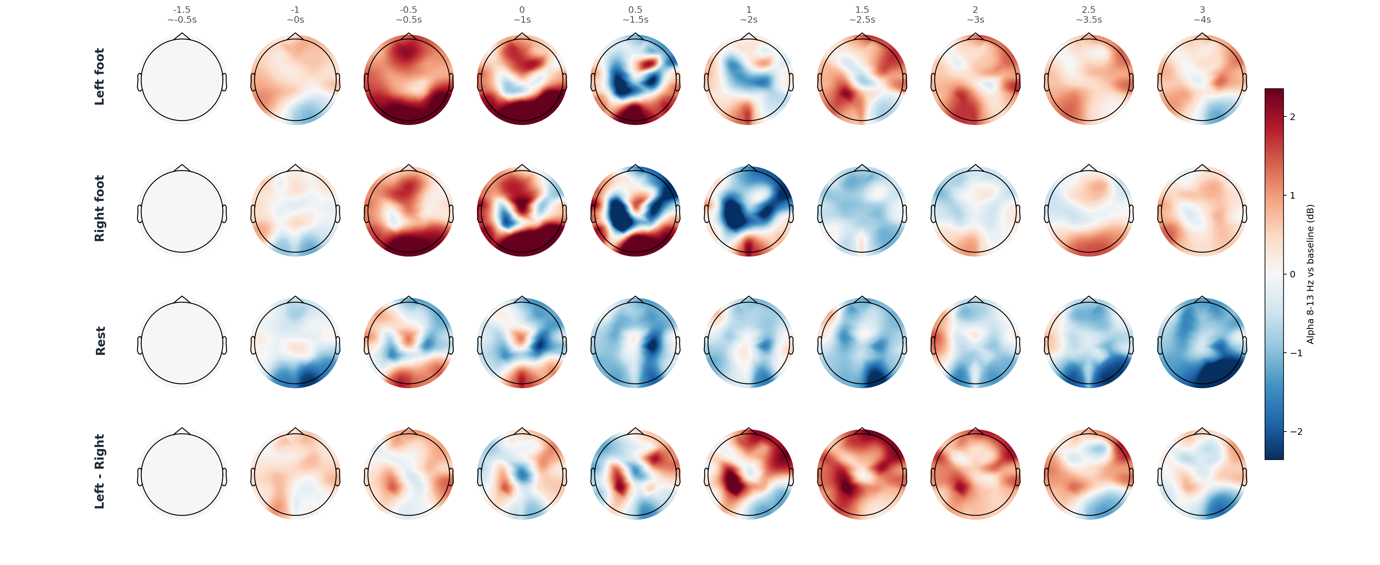 pat4 ASR10 FIR0.5 alpha topomap