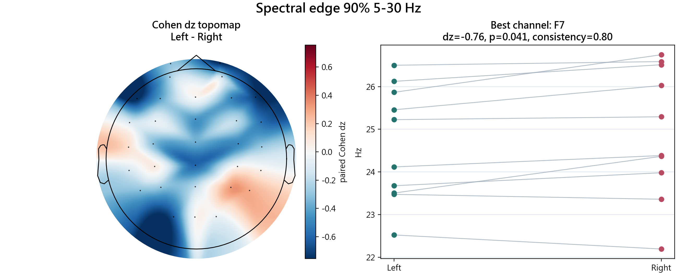 Spectral edge 90% 5-30 Hz feature plot