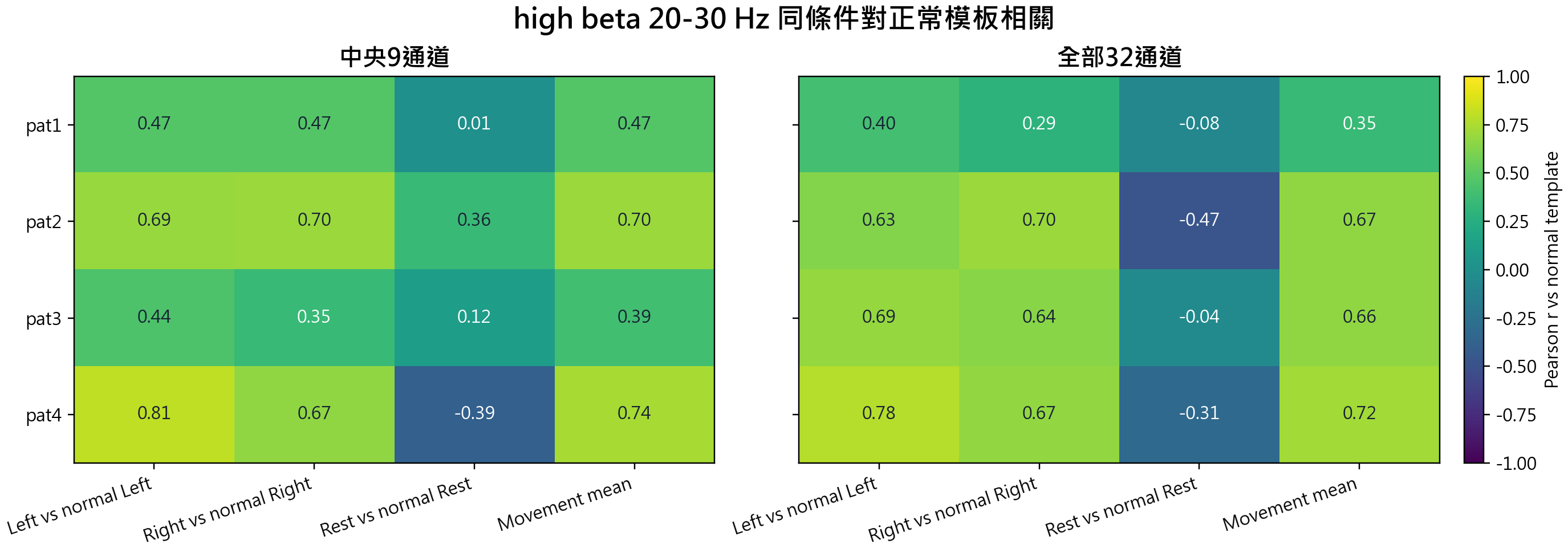 high beta 20-30 Hz same-condition correlation against normal template