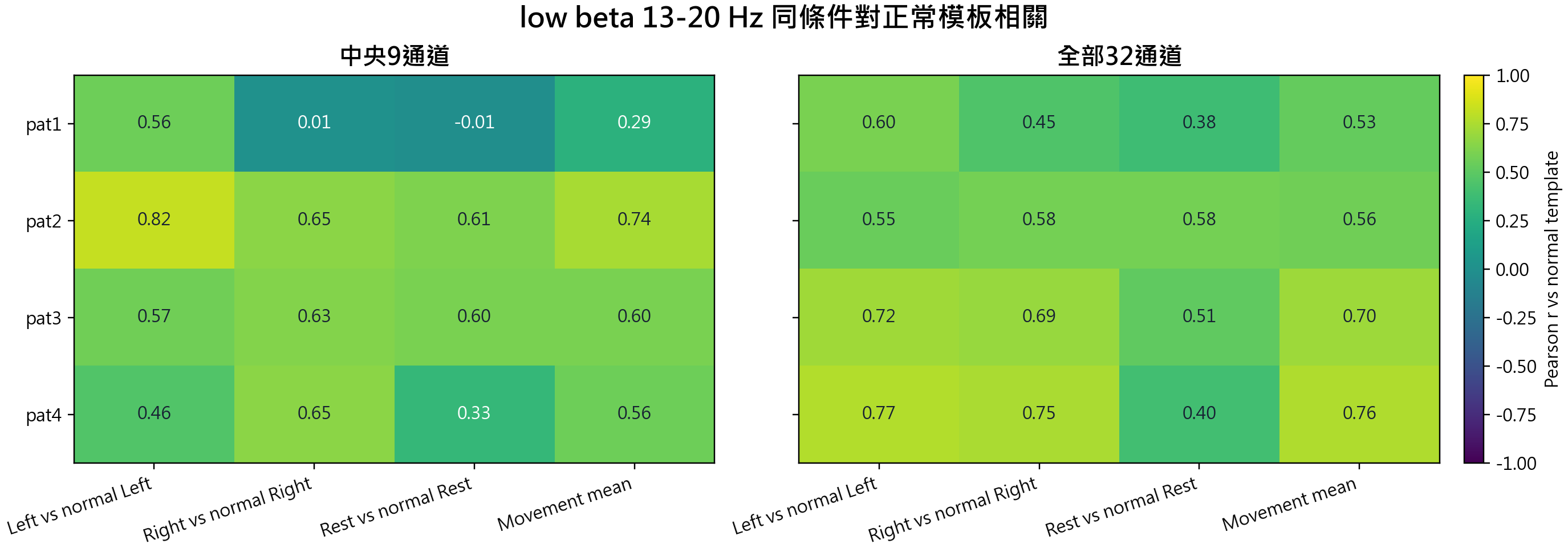 low beta 13-20 Hz same-condition correlation against normal template