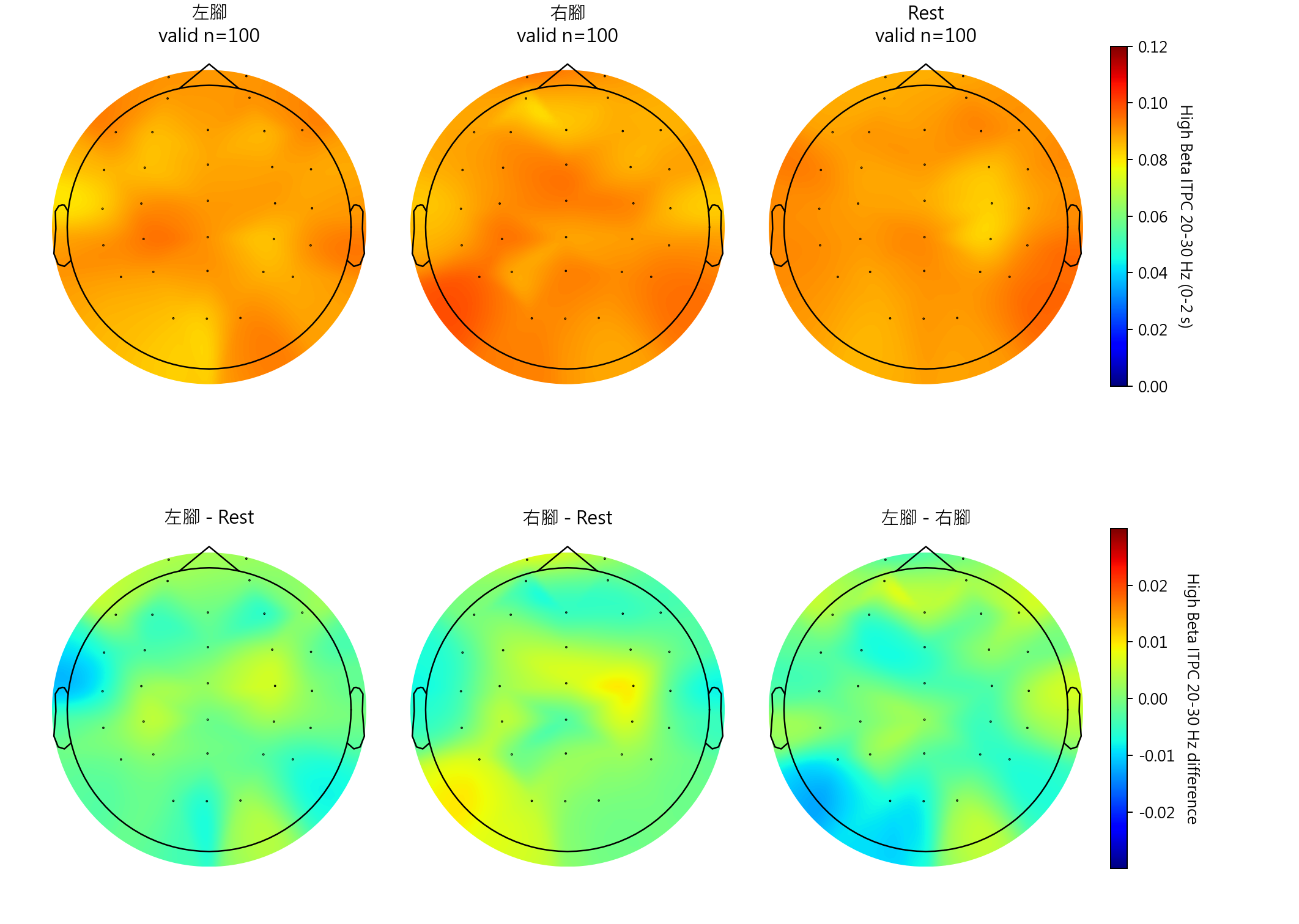 High Beta ITPC 20-30 Hz group mean topomaps