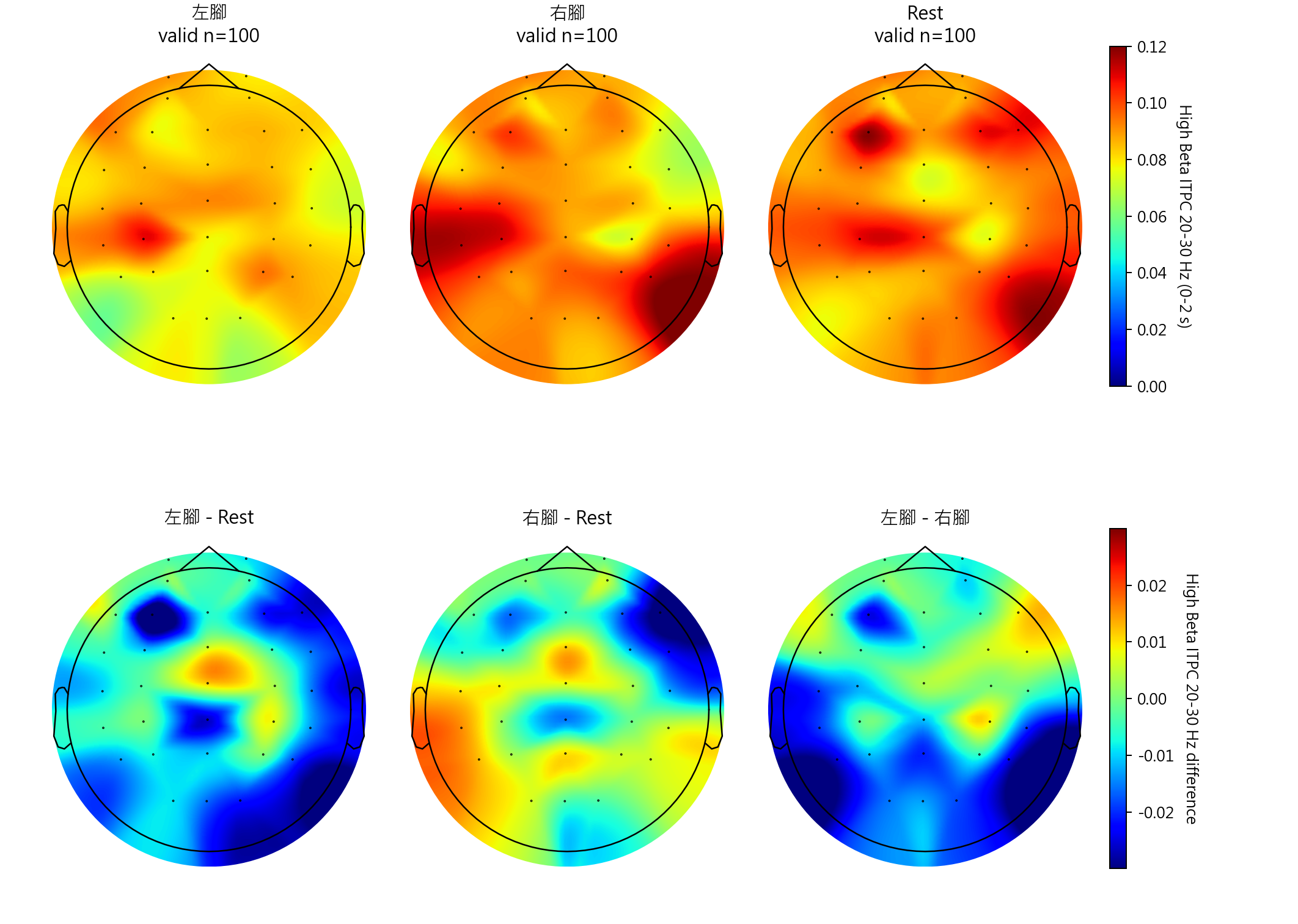 sub11 High Beta ITPC 20-30 Hz topomaps