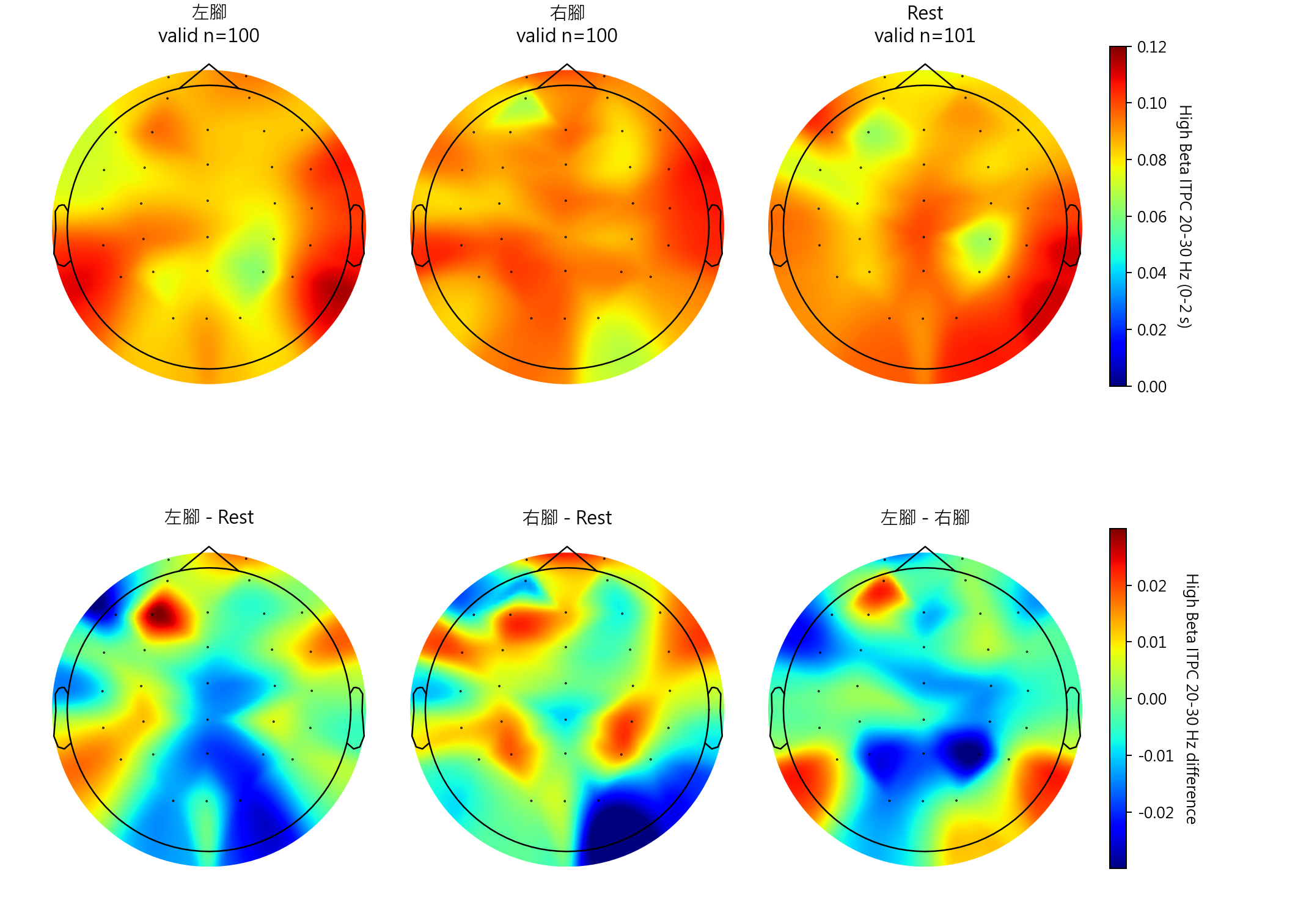sub14 High Beta ITPC 20-30 Hz topomaps