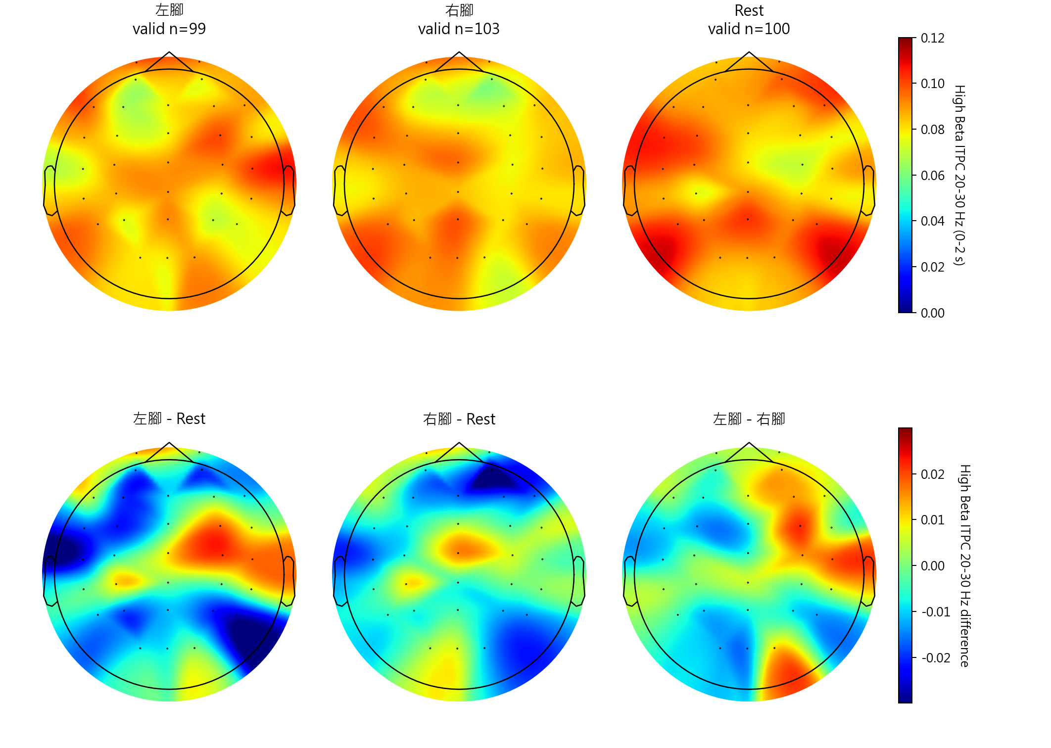 sub1 High Beta ITPC 20-30 Hz topomaps