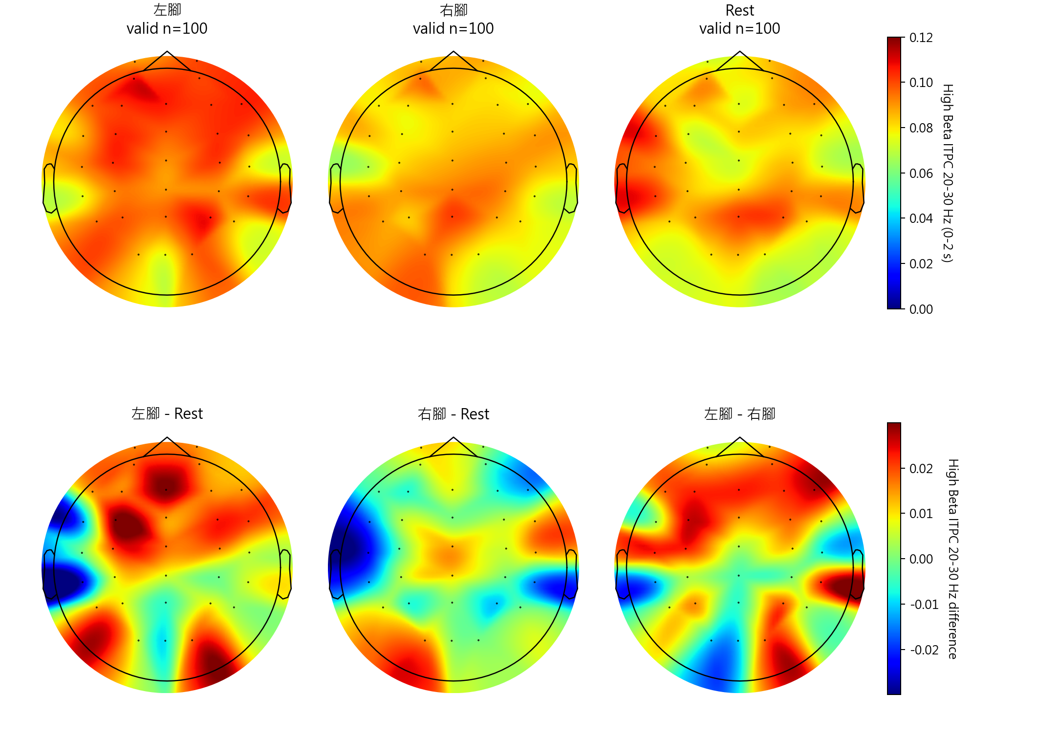 sub9 High Beta ITPC 20-30 Hz topomaps