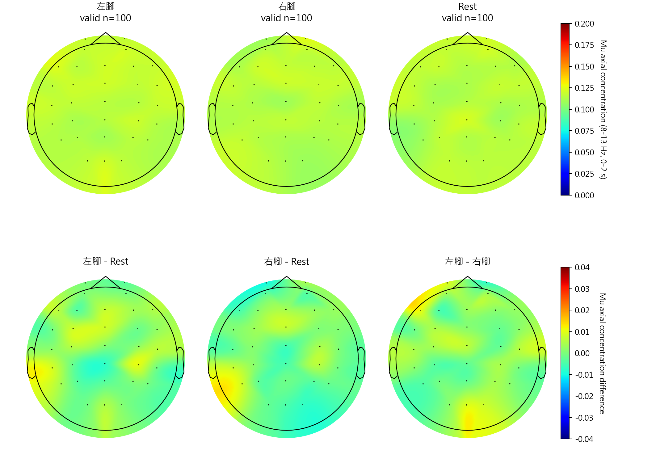 Group mean Mu axial concentration topomaps