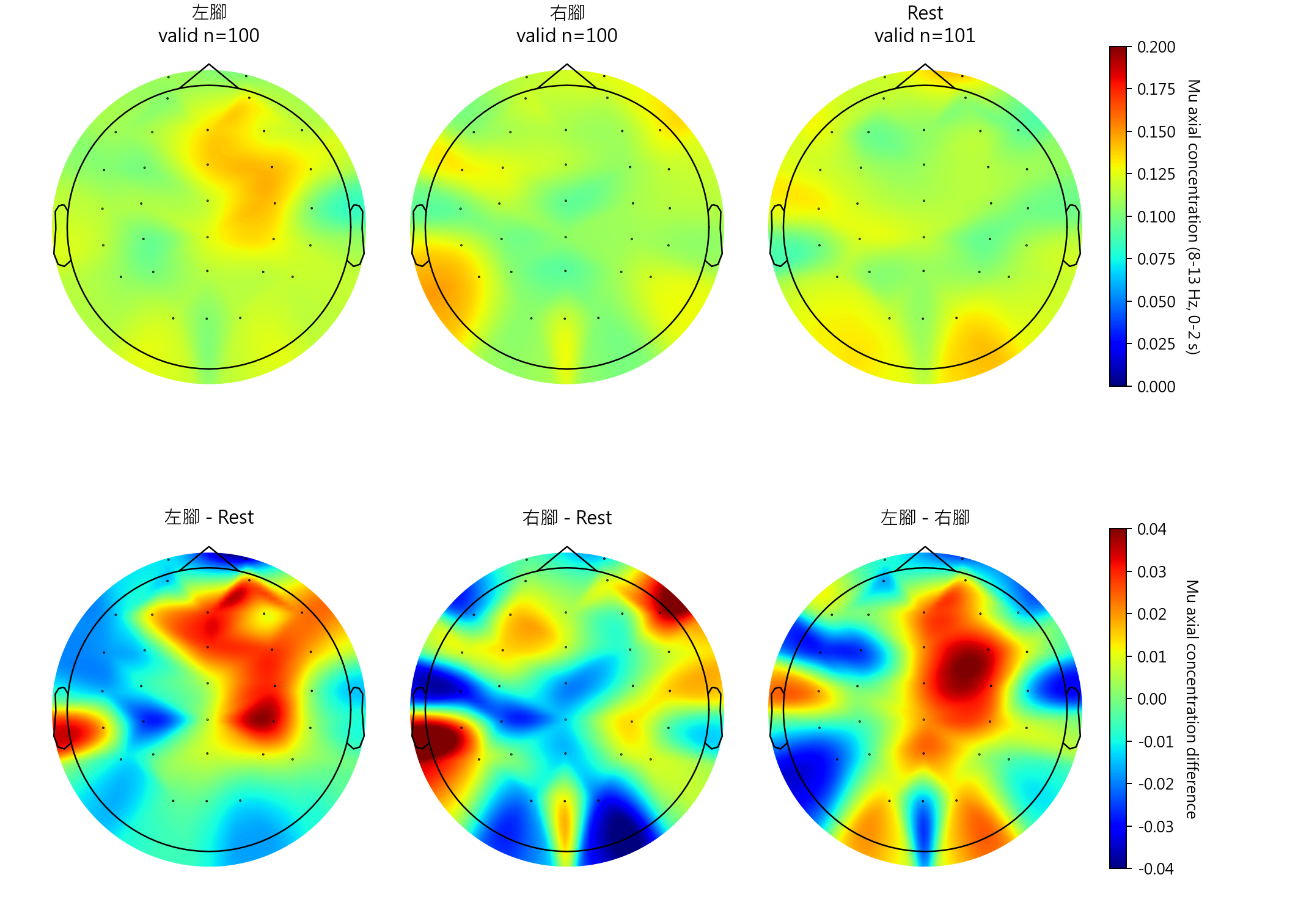 sub10 Mu axial concentration topomaps