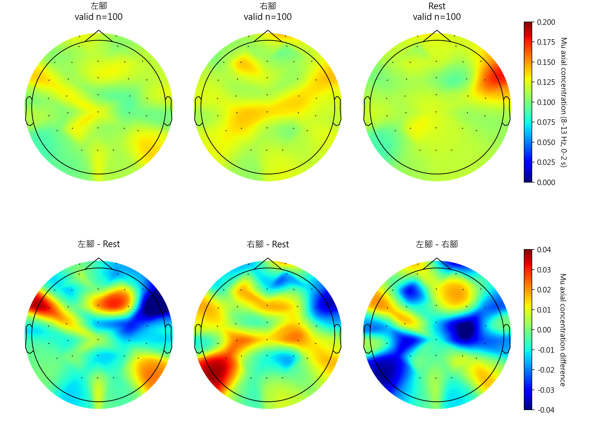 sub11 Mu axial concentration topomaps