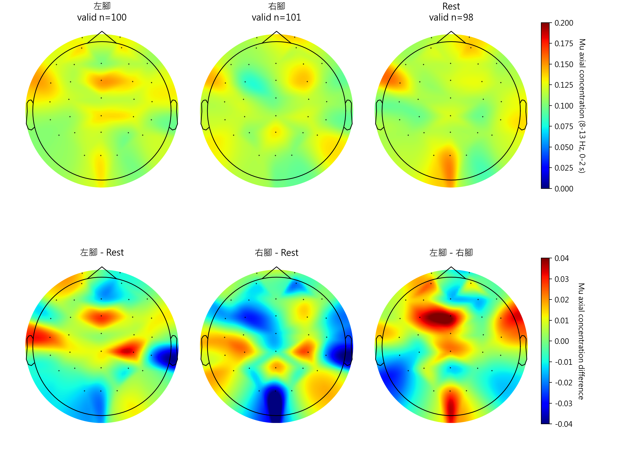 sub12 Mu axial concentration topomaps