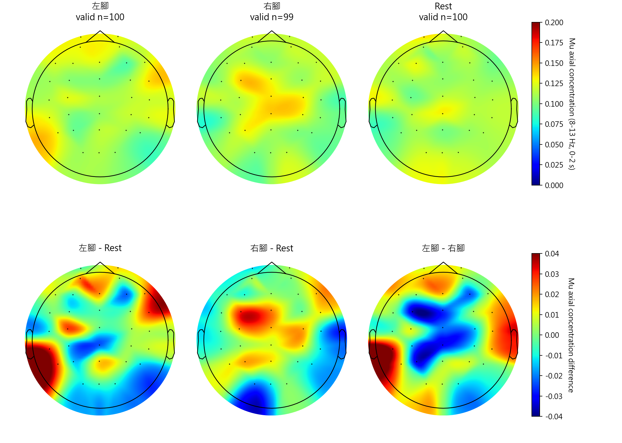 sub13 Mu axial concentration topomaps