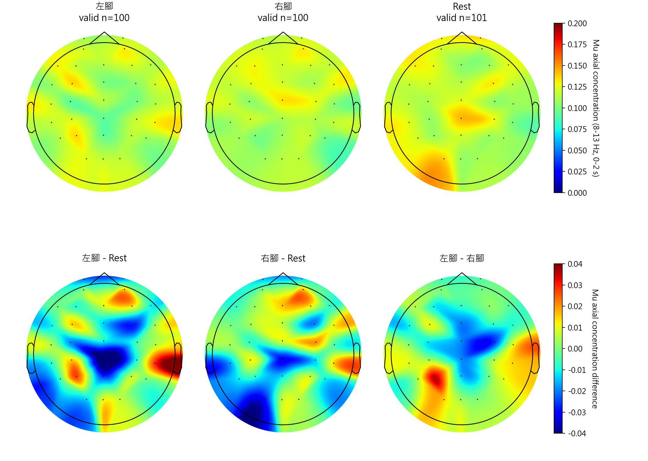 sub14 Mu axial concentration topomaps
