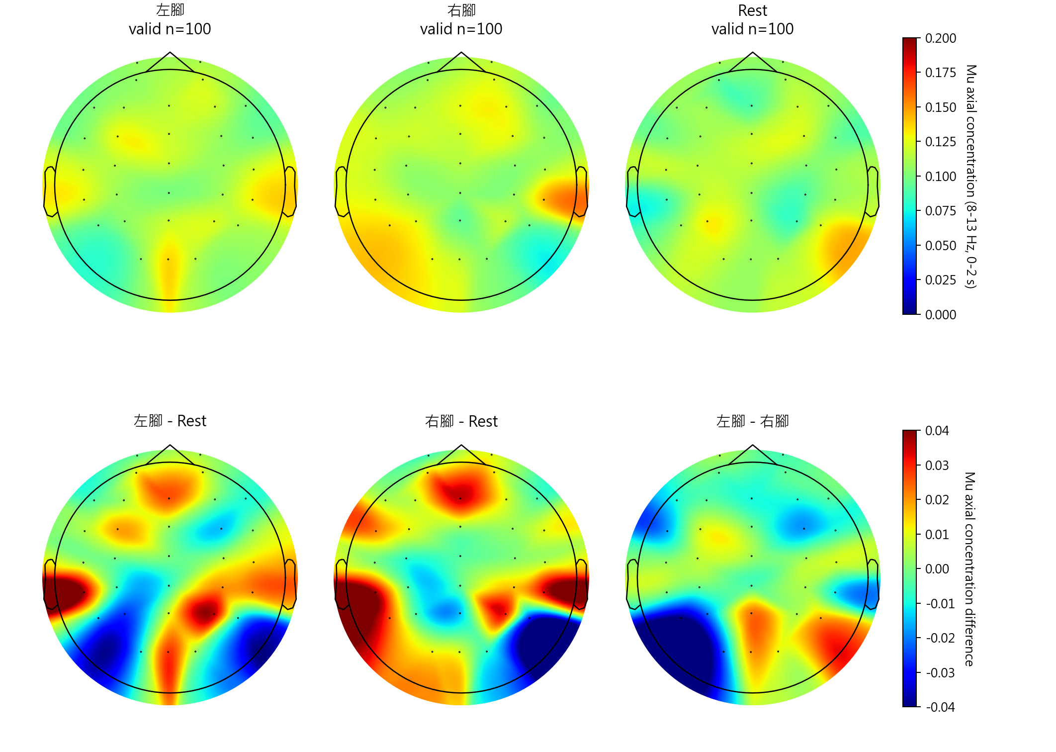 sub15 Mu axial concentration topomaps