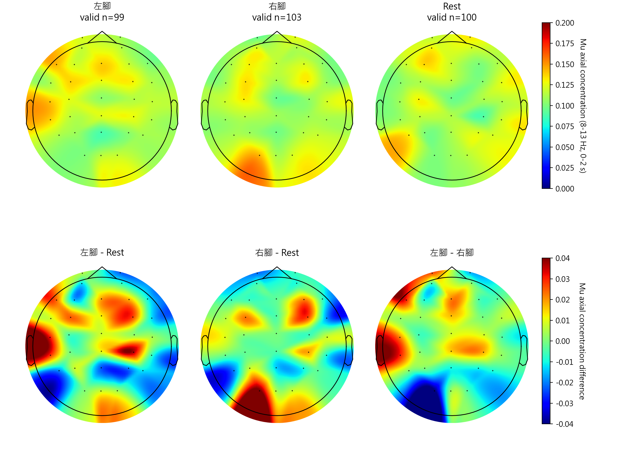 sub1 Mu axial concentration topomaps