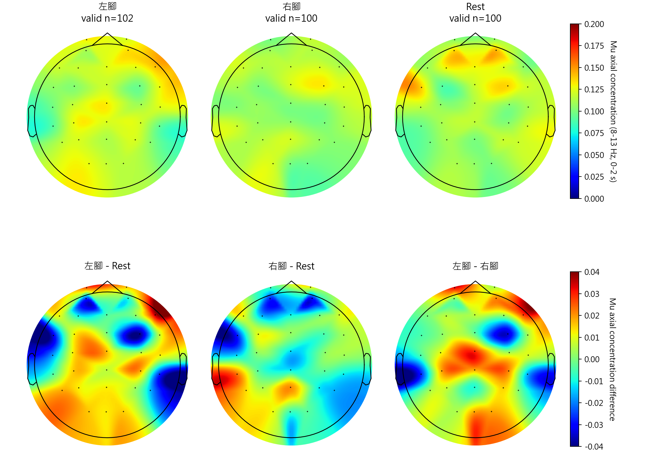 sub2 Mu axial concentration topomaps
