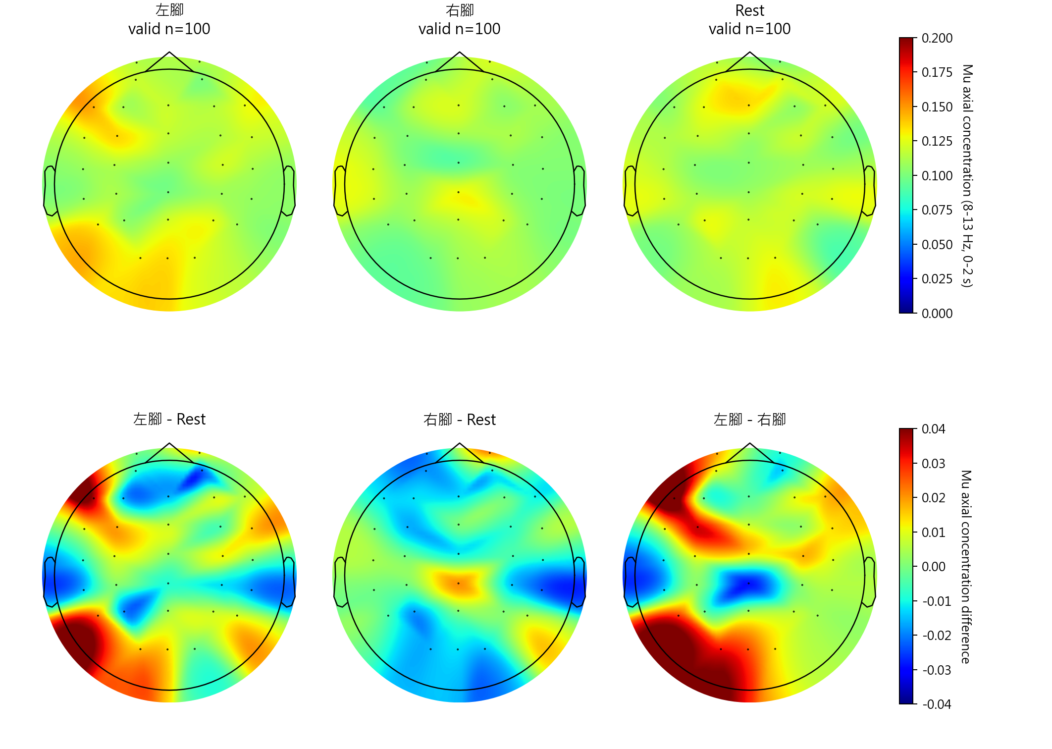 sub3 Mu axial concentration topomaps