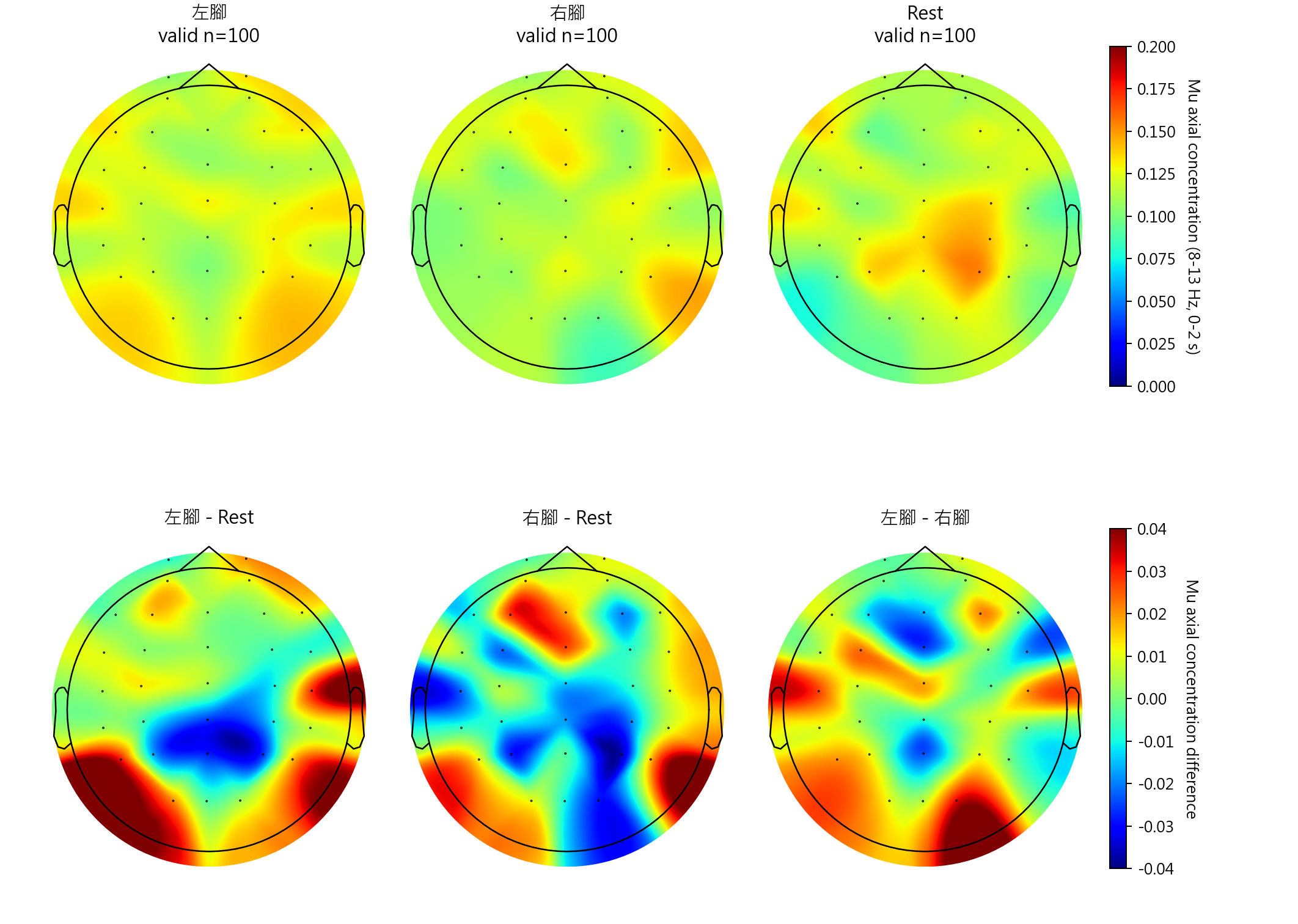 sub9 Mu axial concentration topomaps