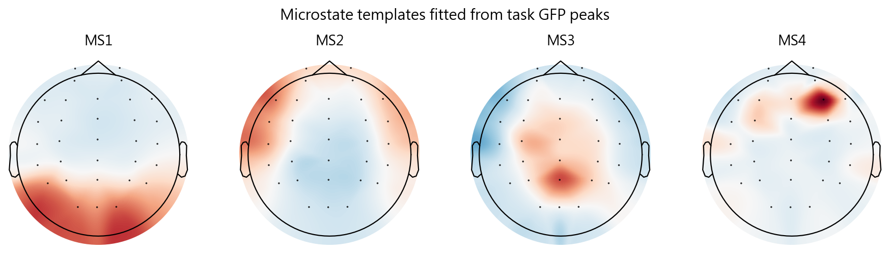 K=4 microstate templates fitted from task-window GFP peaks; polarity-insensitive assignment was used for occupancy.